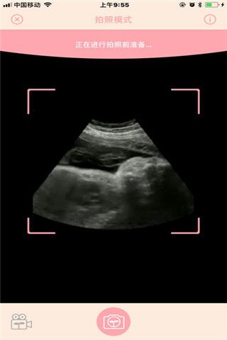 胎儿相机安卓版
